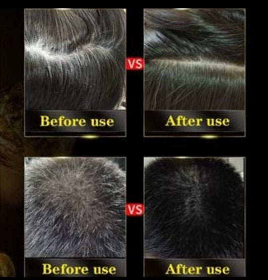 BLACK HAIR DYE SHAMPOO 3-IN-1 (NO SIDE EFFECT) - 🔥Buy 1 Get 1 Free 🔥