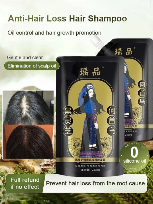 ✨🎁Hot Sale Ginger Plant Extract Anti-Hair Loss Hair Shampoo✨ BUY 1 GET 2 FREE🎁